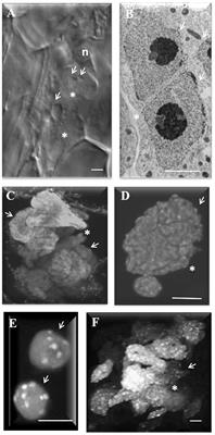 Application of Nuclear Volume Measurements to Comprehend the Cell Cycle in Root-Knot Nematode-Induced Giant Cells